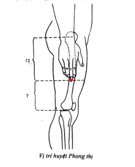 Vị trí huyệt phong thị